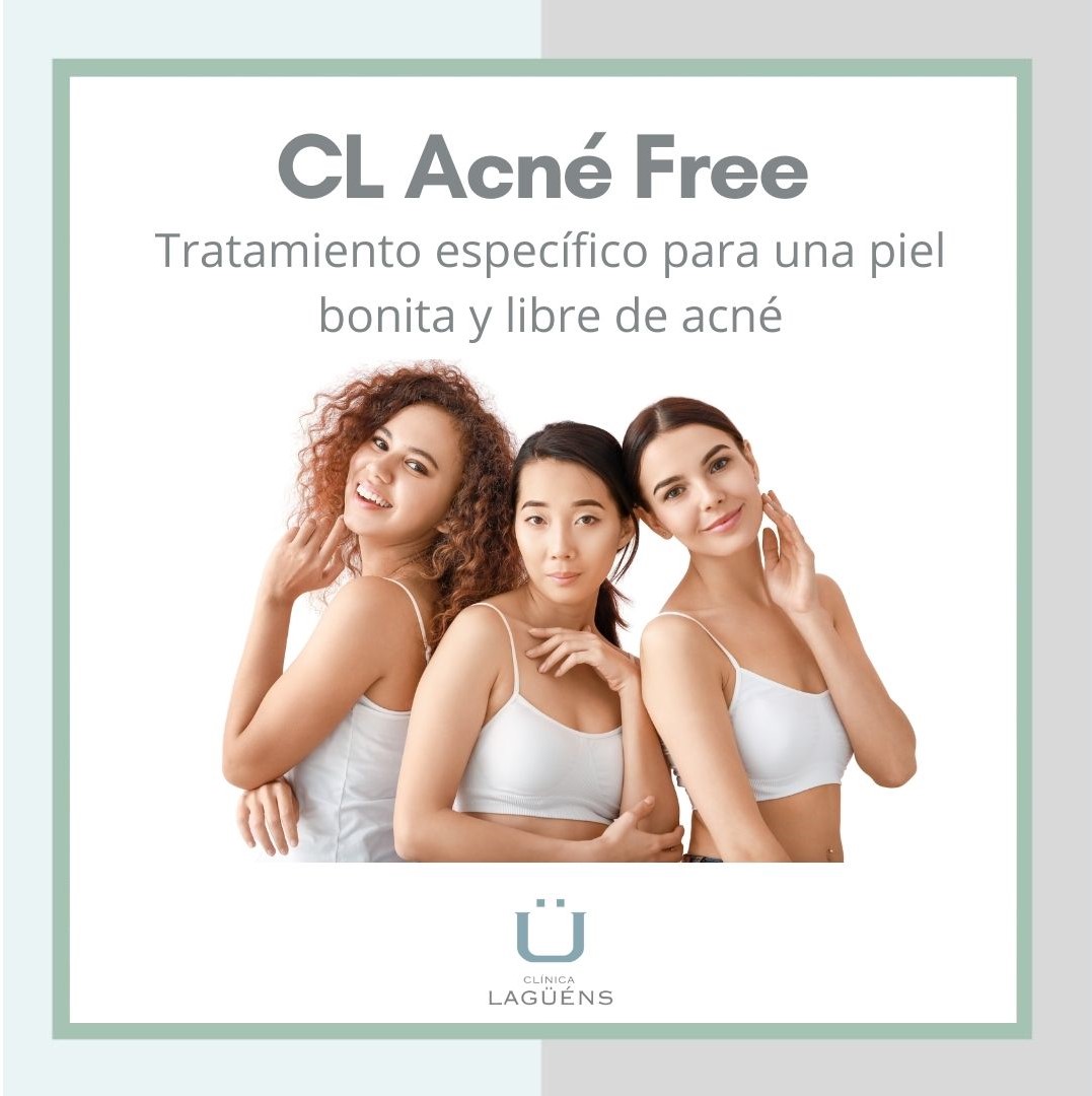 tratamiento acné free en Clínica Lagüéns Sevilla