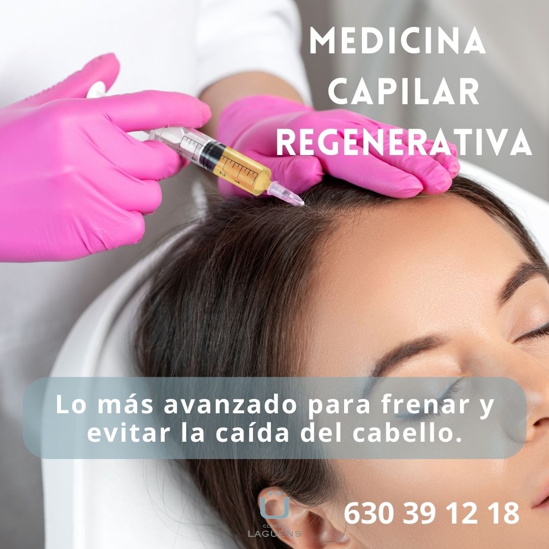 Tratamientos capilares en Sevilla. Medicina Regenerativa.