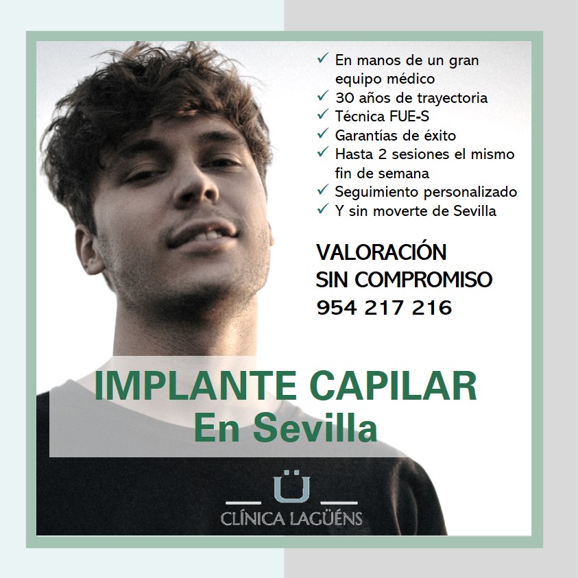Implante capilar en Sevilla