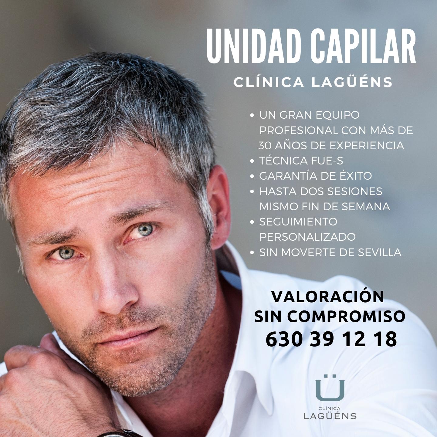 Tratamiento capilar en Clínica Lagüéns, Sevilla 
