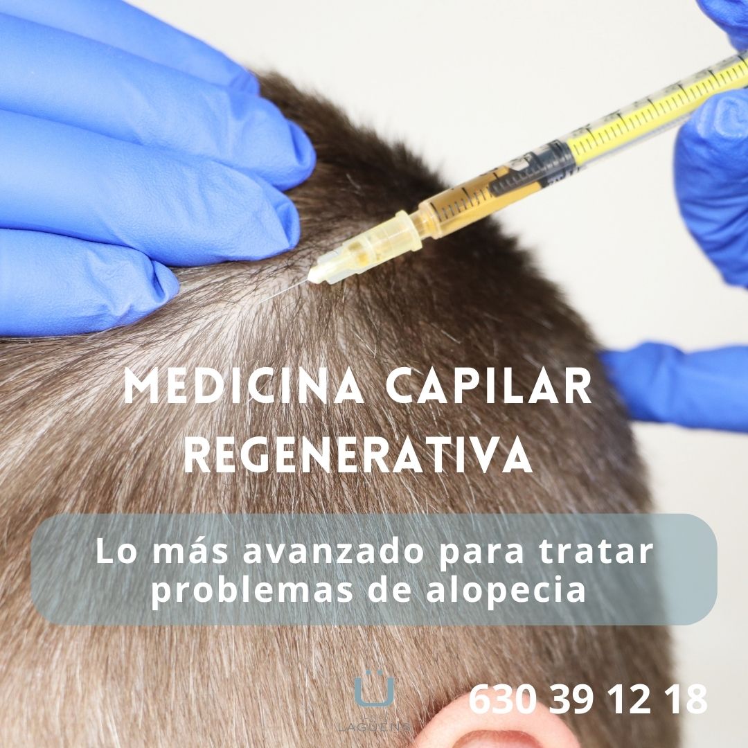 Tratamientos capilares para frenar y revertir la caída del pelo. Sevilla