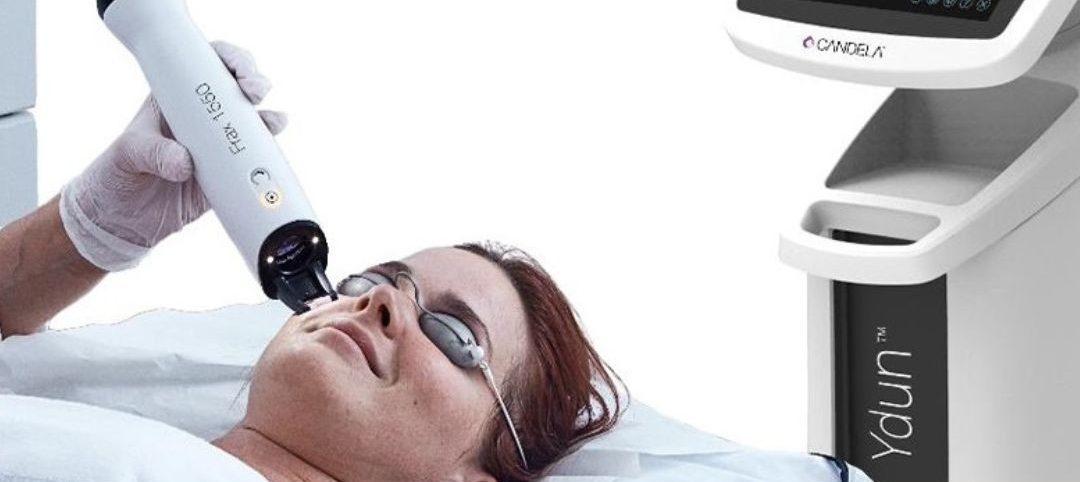 láser rejuvenecimiento facial Ydum Frax fraccionado